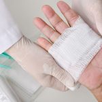 Peptides for wound healing